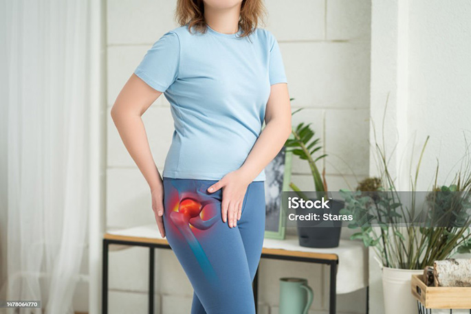 Picture of Hip Joint Woman Suffering from Osteoarthritis