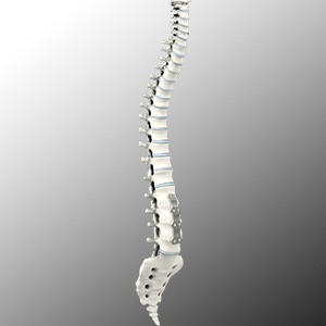 Anterior Lumbar Interbody Fusion Picture