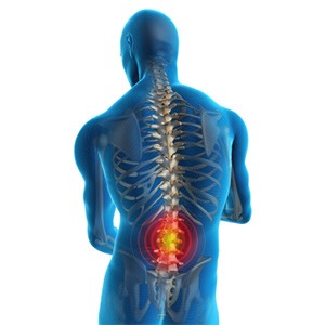 Low Back Pain Picture