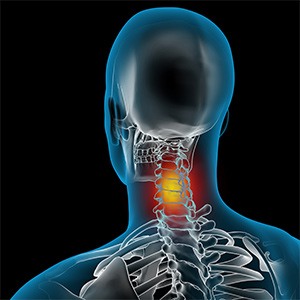 Neck Pain Picture