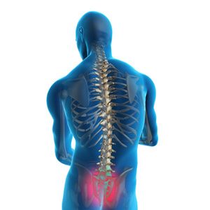 Sacroiliac Joint Dysfunction Picture