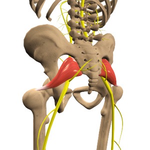 Sciatica Picture
