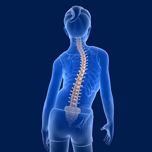 Scoliosis and Spine Deformity Surgery Picture
