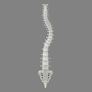 Scoliosis Picture