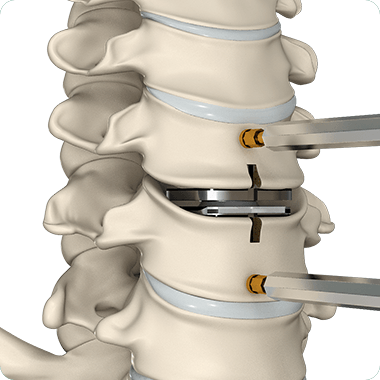 Cervical Spine (Neck) Picture