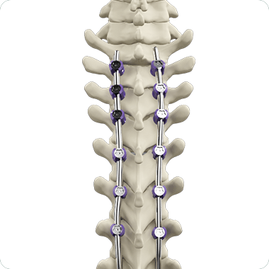 General Spine Procedures Picture