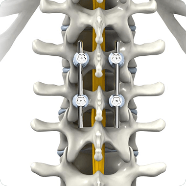 Thoracic Spine (Mid-Back) Picture