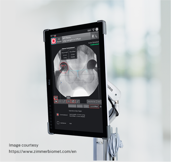 Pure Motion Muscle Sparing Hip Replacement