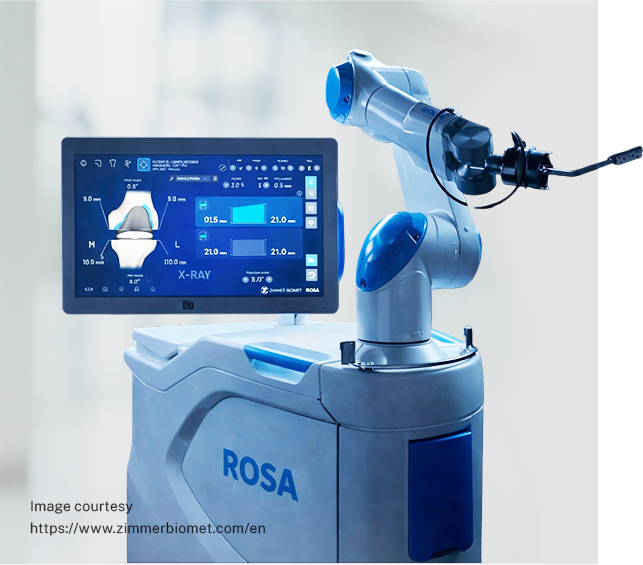 ROSA® Knee with OptimiZe™: Robotic Knee Arthroplasty
