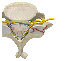 cervical fracture