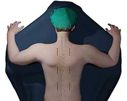 minimally invasive spine surgery