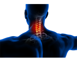 neck pain