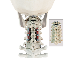 posterior cervical fusion