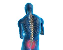 sacroiliac joint dysfunction