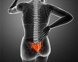 sacroiliac joint pain