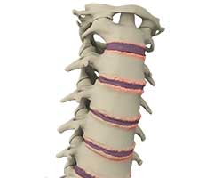 surgical treatment for spine conditions