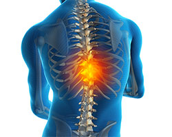 thoracic pain