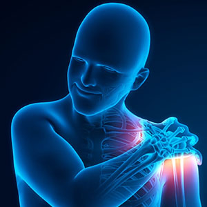 Post-Traumatic Stiffness of the Shoulder Sb
