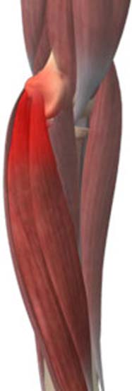 Golfer's Elbow pic