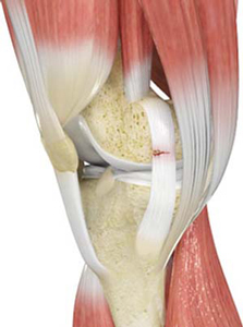 Ligament Injuries pic