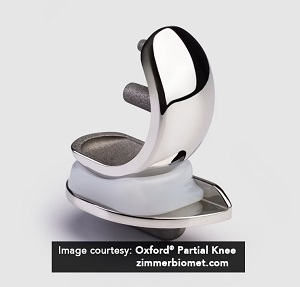 Oxford Unicompartmental Knee Replacement pic