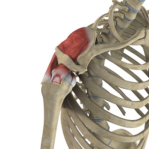 Partial Rotator Cuff Tear pic