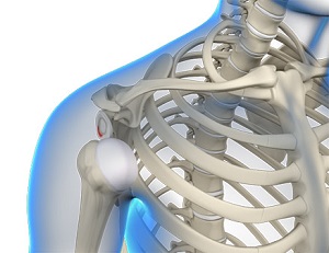 Posterior Shoulder Stabilization pic
