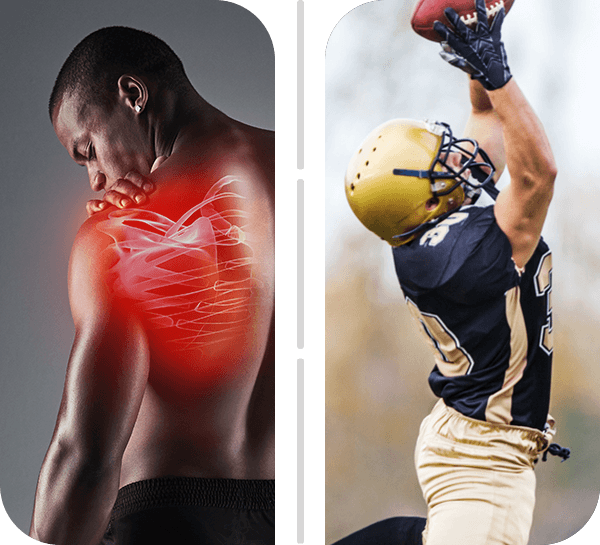 Sports Medicine