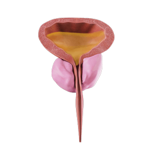 Urinary Retention