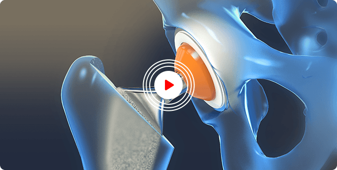 Patient Education Videos of Apex Orthopedics