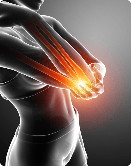 Elbow image