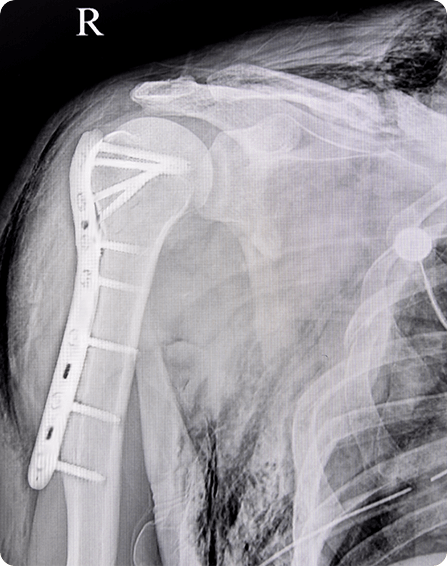 Sports Medicine image