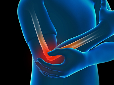 Elbow Injuries - Educational Picture