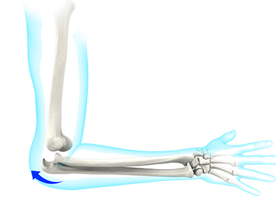 Elbow Instability - Educational Picture