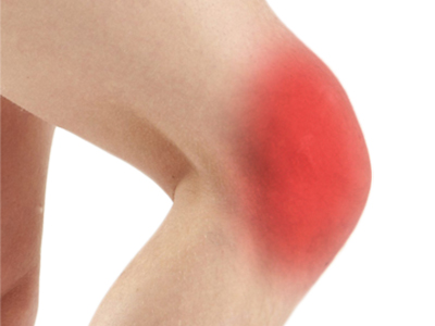 Knee Pain - Educational Picture
