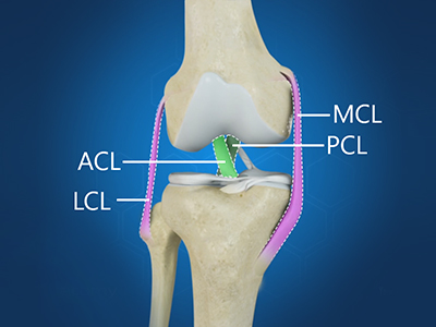 Multiligament Knee Injuries - Educational Picture