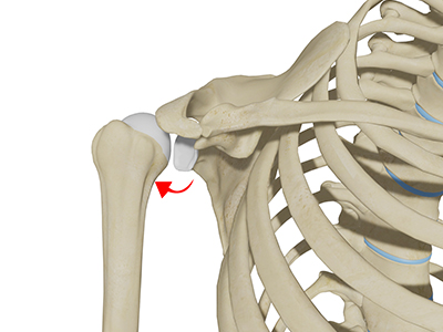 Posterior Shoulder Instability - Educational Picture