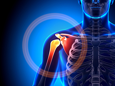 Shoulder Disorders - Educational Picture