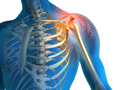 Shoulder Pain - Educational Picture