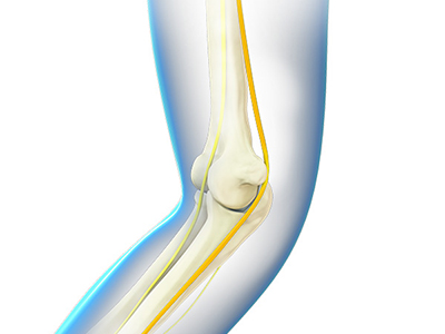Snapping Elbow - Educational Picture