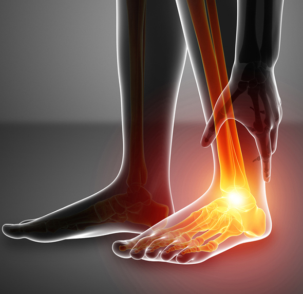 Foot & Ankle - Educational Picture