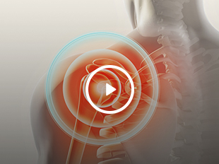 Patient Education Videos