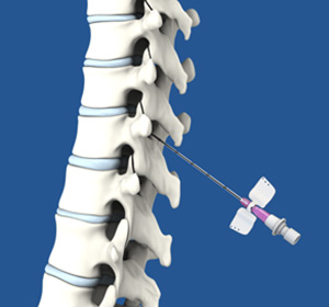 Pain-management Service