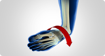 Picture of Ankle Instability