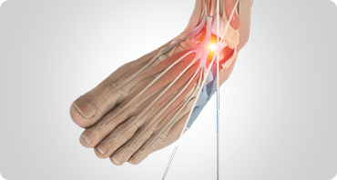 Picture of Foot and Ankle Sports Injuries