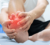 Picture of Hammertoe