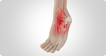 Treatment of Foot & Ankle Sports Injuries