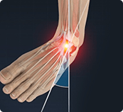 Picture of Sports Injuries