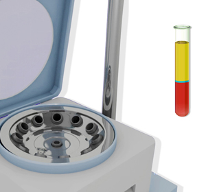 Platelet-Rich Plasma (PRP) Injection