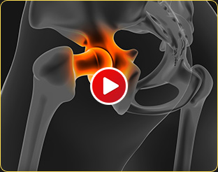 Patient Educational Videos